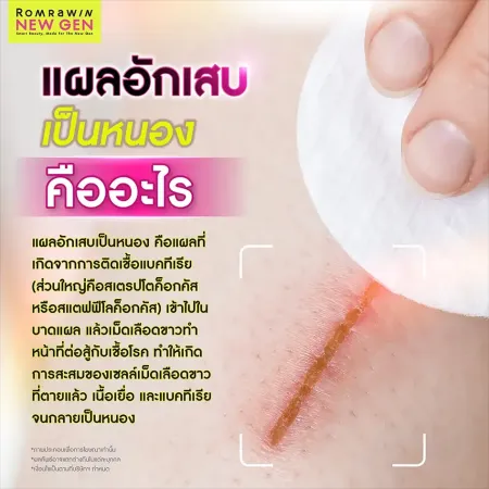 แผลอักเสบเป็นหนอง เกิดจากการติดเชื้อแบคทีเรีย