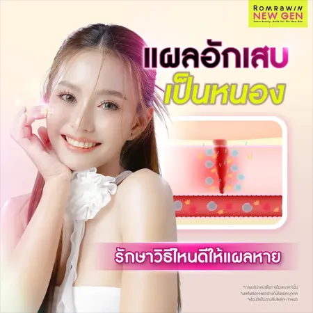 วิธีรักษาแผลอักเสบเป็นหนองอย่างปลอดภัย