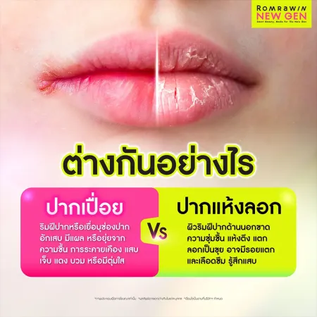 เปรียบเทียบแผลอักเสบในปาก กับริมฝีปากแห้งตึงลอกเป็นขุย