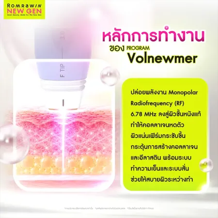 หลักการทำงานของ Program Volnewmer ปล่อยพลังงาน RF 6.78 MHz ลงสู่ชั้นผิว