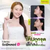 รีวิวฉีดฟิลเลอร์คาง ปรับรูปหน้าวีเชฟเป็นธรรมชาติ คุณแป้ง