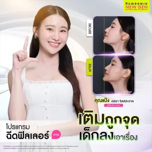 รีวิวฉีดฟิลเลอร์คาง ปรับรูปหน้าวีเชฟเป็นธรรมชาติ คุณแป้ง