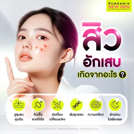 สิวอักเสบเกิดจากอะไร สาเหตุจากรูขุมขนอุดตัน แบคทีเรีย ฮอร์โมน และความเครียด