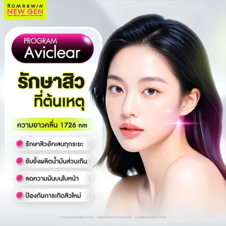 Program AviClear เลเซอร์รักษาสิวคลื่น 1726 nm ยับยั้งความมัน และลดสิวใหม่