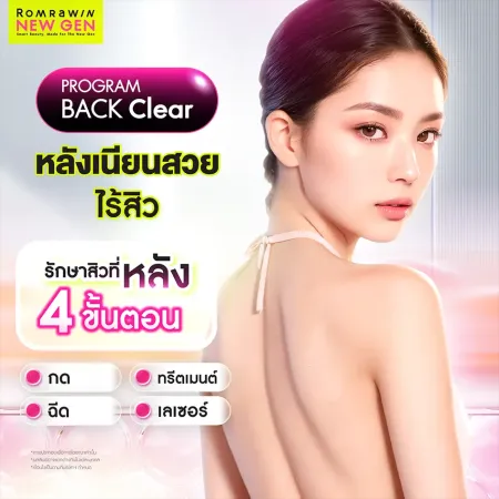 Program BACK Clear รักษาสิวที่หลัง 4 ขั้นตอน กด ฉีด ทรีตเมนต์ เลเซอร์ เผยแผ่นหลังเนียนใส