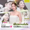 รีวิวฉีดฟิลเลอร์คาง คุณก้อย ปรับหน้าเรียว สมส่วนละมุน
