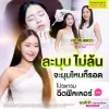 รีวิวฉีดฟิลเลอร์คาง คุณจ๊ะจ๋า ปรับหน้าเรียว ละมุนธรรมชาติ