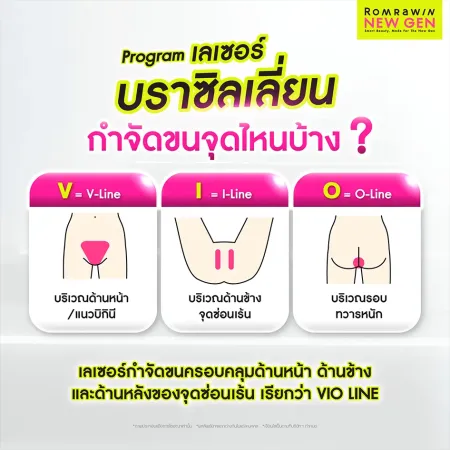 เลเซอร์ขนบราซิลเลียนกำจัดขนจุดไหนบ้าง โซน VIO Line โดยแพทย์