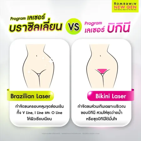 เปรียบเทียบเลเซอร์ขนบราซิลเลียน VS เลเซอร์ขนบิกินี แตกต่างกันอย่างไร