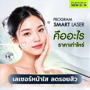 Smart Laser คืออะไร ราคาเท่าไหร่ เลเซอร์หน้าใส ลดรอยสิว