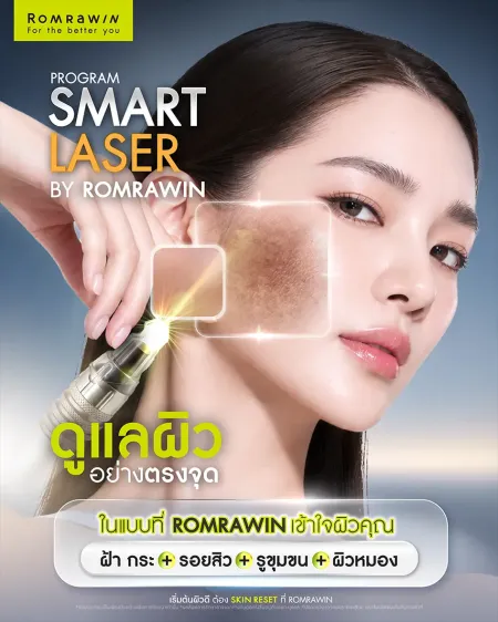 Program Smart Laser รักษาฝ้า กระ รอยสิว และจุดด่างดำ