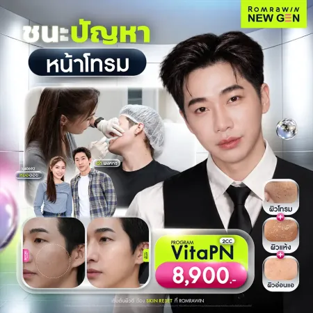 รีวิว VitaPN (Vitaran) 2CC ก่อนหลัง ผิวหน้าโทรม พร้อมราคาโปรโมชั่น 8,900 บาท